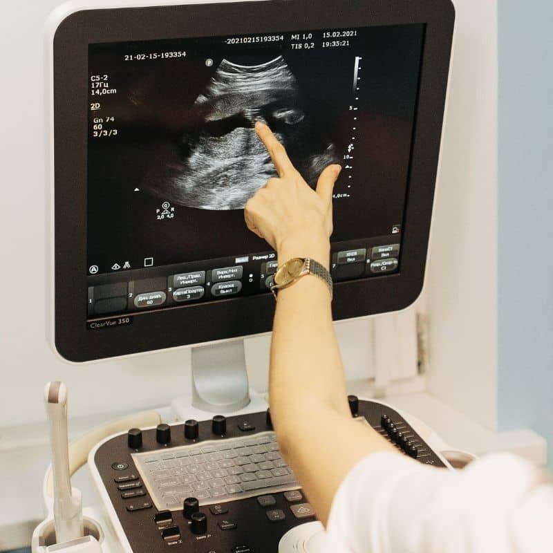 Why Choose Our Ultrasound Services